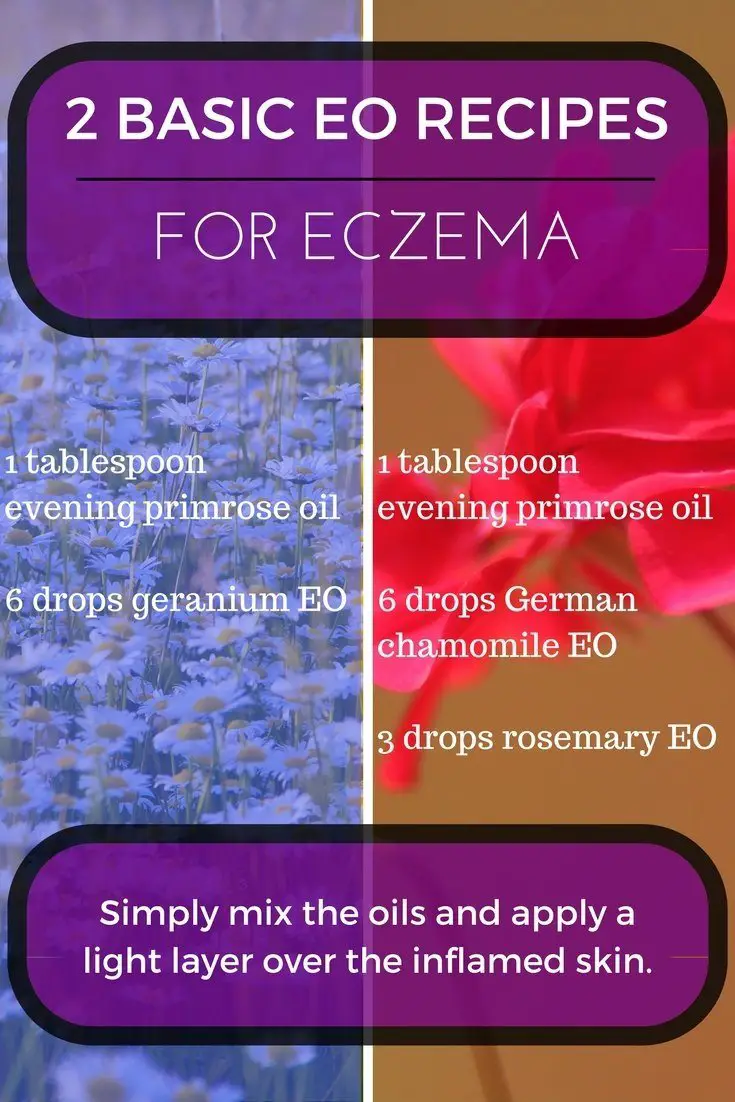 Essential Oils For Eczema Heal Your Skin And Eliminate Flare Ups