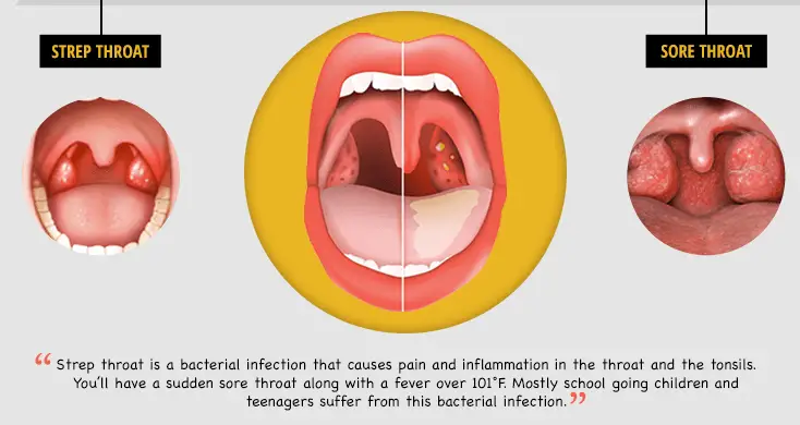 10 Essential Oils For Sore Throat And Rapid Relief