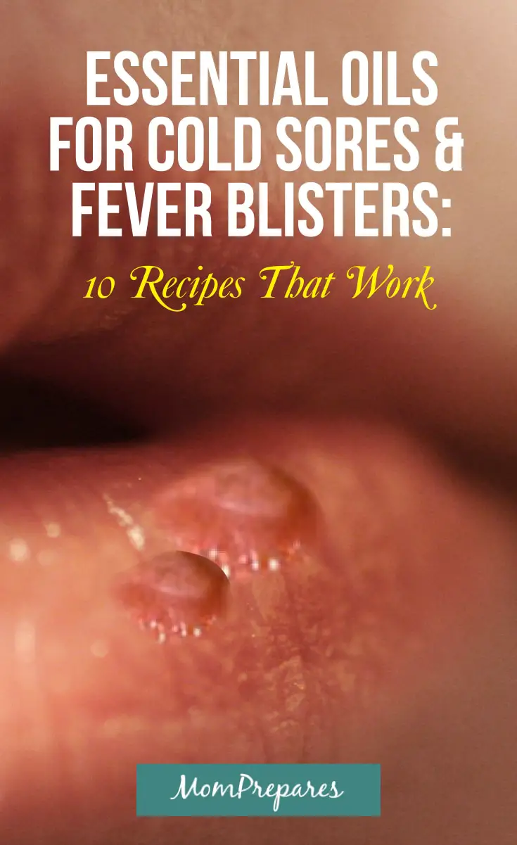 and Oils Sores (10 For Fever Recipes ... Blisters Cold Essential