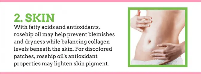 rosehip oil is good for oily skin